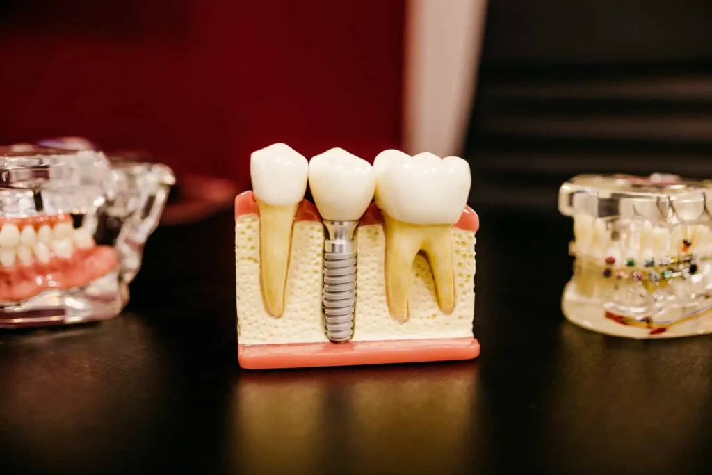 Key Elements of Dental Care Building a Strong Foundation for Oral Health