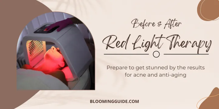 Red Light Therapy Before and After: results, Benefits & Risks